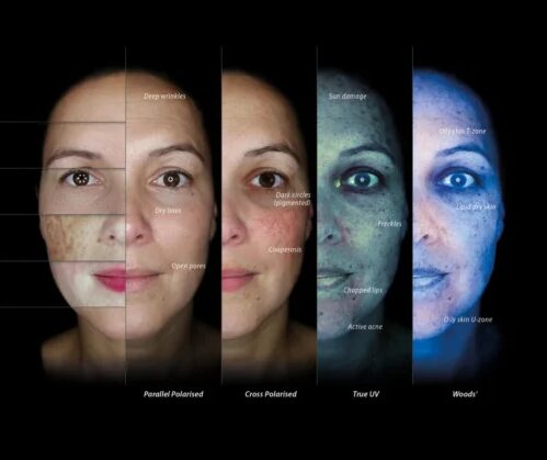 aging skin treatments near me leeds