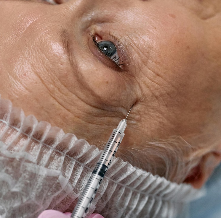 fine lines and wrinkles treatment leeds